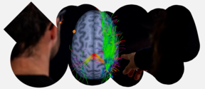 Brain MRI with colourful illustrations of the brain activity inside a white, abstract frame.