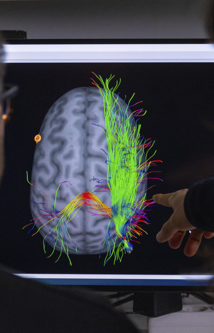 Colourful simulation of the brain activity.