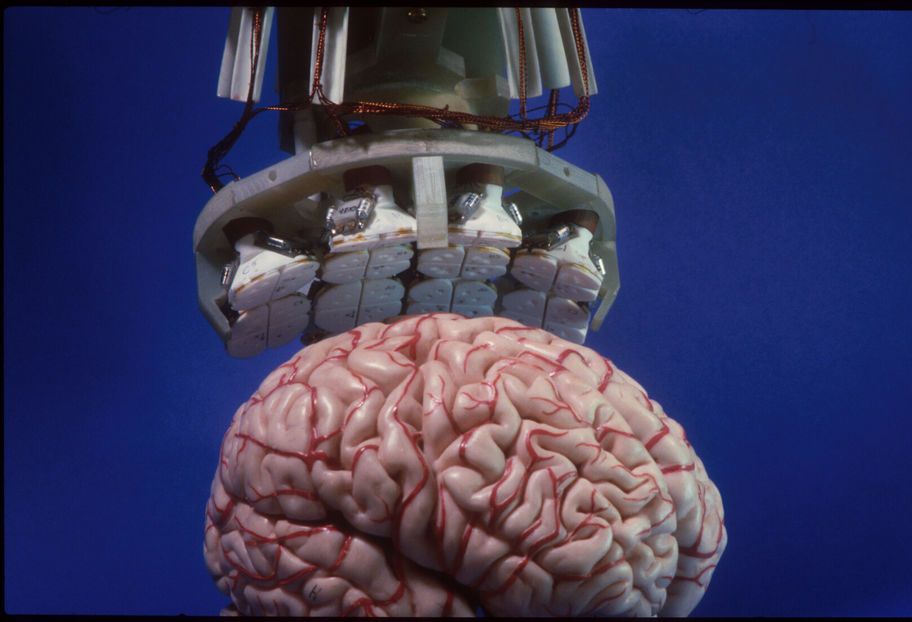 In front of a blue background, there is a plastic model of a human brain in pink, with red veins in the foreground of the image. A metal and plastic mechanical structure is visbile above this model and reaches to the top of the image. Copper wires run along the outside of the top of the structure. The base of the structure circular in shape and has rows of plastic white funnels which are above the brain model. The surface of each funnel base is divided into four equal quadrants.